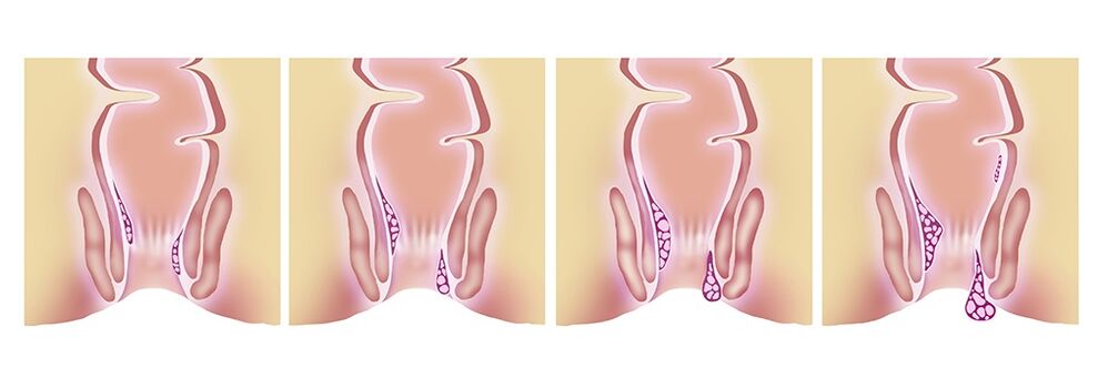 Gelarex efficace à toutes les étapes